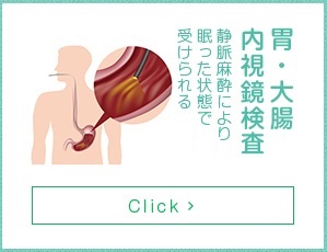 胃・大腸内視鏡検査イメージ